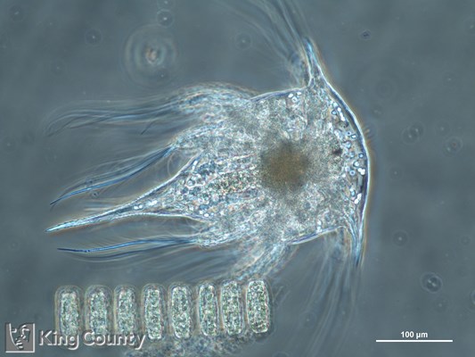 Photo of Cirripedia: larval stages